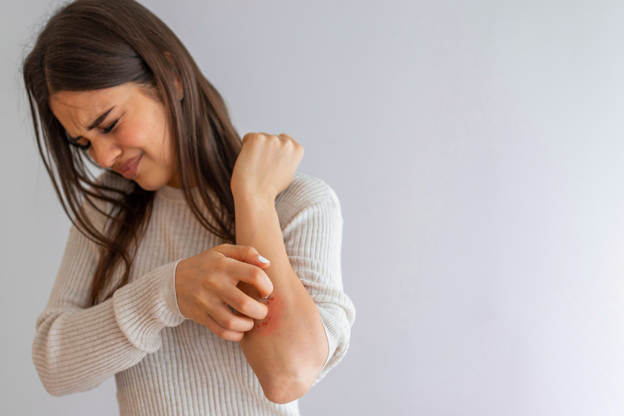 Is Your Water Affecting Your Skin? The Hidden Link Between Unfiltered Water and Skin Conditions Like Eczema